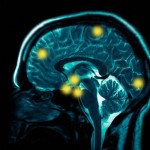 brainscanspost1